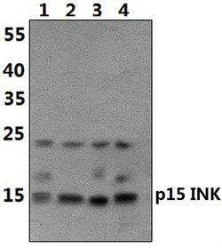 CDKN2B Polyclonal Antibody:Antibodies, Polyclonal