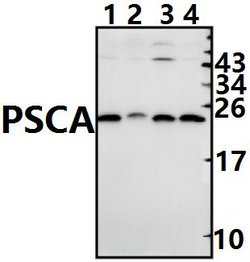 PSCA Polyclonal Antibody:Antibodies, Polyclonal