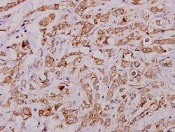 Invitrogen PLA2G4A Polyclonal Antibody 100 &mu;L | Buy Online | Invitrogen&trade; | Fisher Scientific