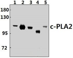 Invitrogen PLA2G4A Polyclonal Antibody 100 &mu;L | Buy Online | Invitrogen&trade; | Fisher Scientific