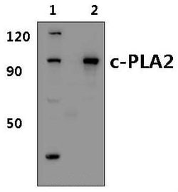 Invitrogen PLA2G4A Polyclonal Antibody 100 &mu;L | Buy Online | Invitrogen&trade; | Fisher Scientific