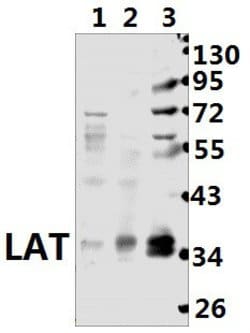 Invitrogen LAT Polyclonal Antibody 100 &mu;L; Unconjugated:Antibodies,