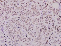 Invitrogen WAVE1 Polyclonal Antibody 100 &mu;L; Unconjugated:Antibodies,