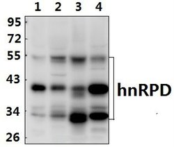 Invitrogen hnRNP D Polyclonal Antibody 100 &mu;L | Buy Online | Invitrogen&trade; | Fisher Scientific