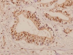 Invitrogen PMP22 Polyclonal Antibody 100 &mu;L; Unconjugated:Antibodies,