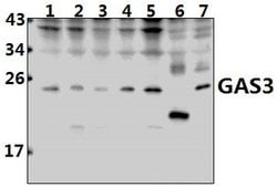 Invitrogen PMP22 Polyclonal Antibody 100 &mu;L; Unconjugated:Antibodies,