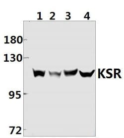 KSR1 Polyclonal Antibody:Antibodies, Polyclonal