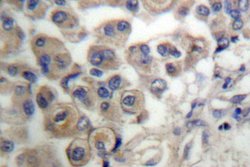 PLCB3 Polyclonal Antibody:Antibodies, Polyclonal