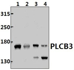 PLCB3 Polyclonal Antibody:Antibodies, Polyclonal