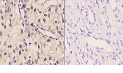 Invitrogen TBX1 Polyclonal Antibody 100 &mu;L; Unconjugated:Antibodies,