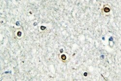 Invitrogen ATF7 Polyclonal Antibody 100 &mu;L | Buy Online | Invitrogen&trade; | Fisher Scientific