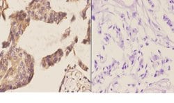 Invitrogen NCBP2 Polyclonal Antibody 100 &mu;L; Unconjugated:Antibodies,