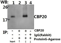 Invitrogen NCBP2 Polyclonal Antibody 100 &mu;L; Unconjugated:Antibodies,