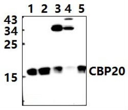 Invitrogen NCBP2 Polyclonal Antibody 100 &mu;L; Unconjugated:Antibodies,