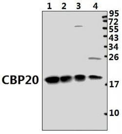 Invitrogen NCBP2 Polyclonal Antibody 100 &mu;L; Unconjugated:Antibodies,