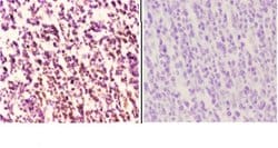 Invitrogen MEF2B Polyclonal Antibody 100 &mu;L; Unconjugated:Antibodies,