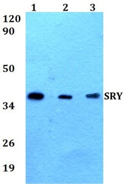 Invitrogen SRY Polyclonal Antibody 100 &mu;L; Unconjugated:Antibodies,