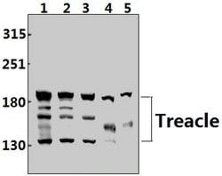 Invitrogen TCOF1 Polyclonal Antibody 100 &mu;L; Unconjugated:Antibodies,