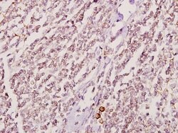 Invitrogen GK2 Polyclonal Antibody 100 &mu;L; Unconjugated:Antibodies,
