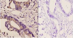 Invitrogen DGKD Polyclonal Antibody 100 &mu;L; Unconjugated:Antibodies,