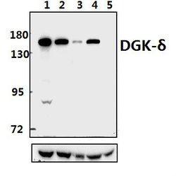 Invitrogen DGKD Polyclonal Antibody 100 &mu;L; Unconjugated:Antibodies,