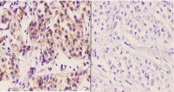 Invitrogen DCP1A Polyclonal Antibody 100 &mu;L; Unconjugated:Antibodies,
