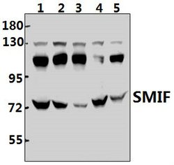 Invitrogen DCP1A Polyclonal Antibody 100 &mu;L; Unconjugated:Antibodies,