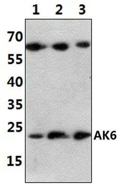 Invitrogen AK6 Polyclonal Antibody 100 &mu;L; Unconjugated:Antibodies,