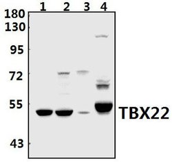 Invitrogen TBX22 Polyclonal Antibody 100 &mu;L; Unconjugated:Antibodies,