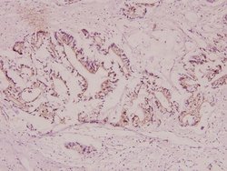 Invitrogen CYP21A2 Polyclonal Antibody 100 &mu;L; Unconjugated:Antibodies,