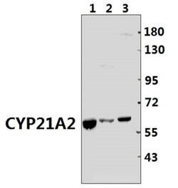Invitrogen CYP21A2 Polyclonal Antibody 100 &mu;L; Unconjugated:Antibodies,
