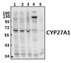 Invitrogen CYP27A1 Polyclonal Antibody 100 &mu;L; Unconjugated:Antibodies,