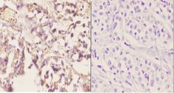 Invitrogen CYP2A13 Polyclonal Antibody 100 &mu;L; Unconjugated:Antibodies,