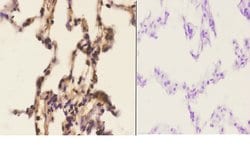 Invitrogen APC6 Polyclonal Antibody 100 &mu;L; Unconjugated:Antibodies,
