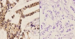 Invitrogen APC6 Polyclonal Antibody 100 &mu;L; Unconjugated:Antibodies,