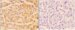 Invitrogen Adenylate Cyclase 5/6 Polyclonal Antibody 100 &mu;L; Unconjugated:Antibodies,