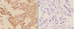 Invitrogen Adenylate Cyclase 5/6 Polyclonal Antibody 100 &mu;L; Unconjugated:Antibodies,