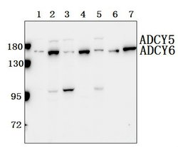 Invitrogen Adenylate Cyclase 5/6 Polyclonal Antibody 100 &mu;L; Unconjugated:Antibodies,