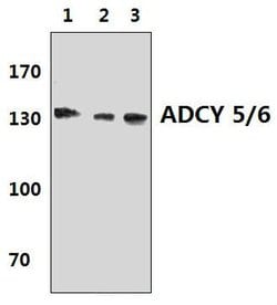 Invitrogen Adenylate Cyclase 5/6 Polyclonal Antibody 100 &mu;L; Unconjugated:Antibodies,