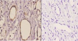 TANK Polyclonal Antibody:Antibodies, Polyclonal