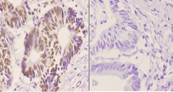 Invitrogen hnRNP C1/C2 Polyclonal Antibody 100 &mu;L; Unconjugated:Antibodies,