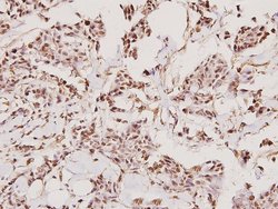 Invitrogen TMPRSS3 Polyclonal Antibody 100 &mu;L; Unconjugated:Antibodies,