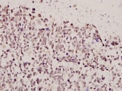 Invitrogen FOXE3 Polyclonal Antibody 100 &mu;L; Unconjugated:Antibodies,