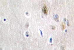 Invitrogen TRA2A Polyclonal Antibody 100 &mu;L; Unconjugated:Antibodies,