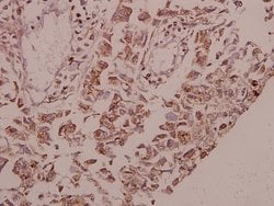 Invitrogen Glycerol kinase Polyclonal Antibody 100 &mu;L; Unconjugated:Antibodies,