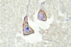 Invitrogen KSR2 Polyclonal Antibody 100 &mu;L; Unconjugated:Antibodies,