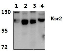 Invitrogen KSR2 Polyclonal Antibody 100 &mu;L; Unconjugated:Antibodies,