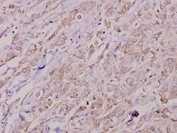 Invitrogen COL4A2 Polyclonal Antibody 100 &mu;L | Buy Online | Invitrogen&trade; | Fisher Scientific