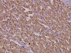 Invitrogen&trade;&nbsp;MSH3 Polyclonal Antibody