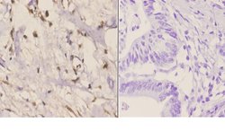 RAD51C Polyclonal Antibody:Antibodies, Polyclonal